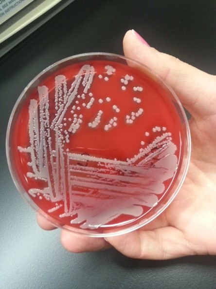 Petri dish with Staphylococcus aureus